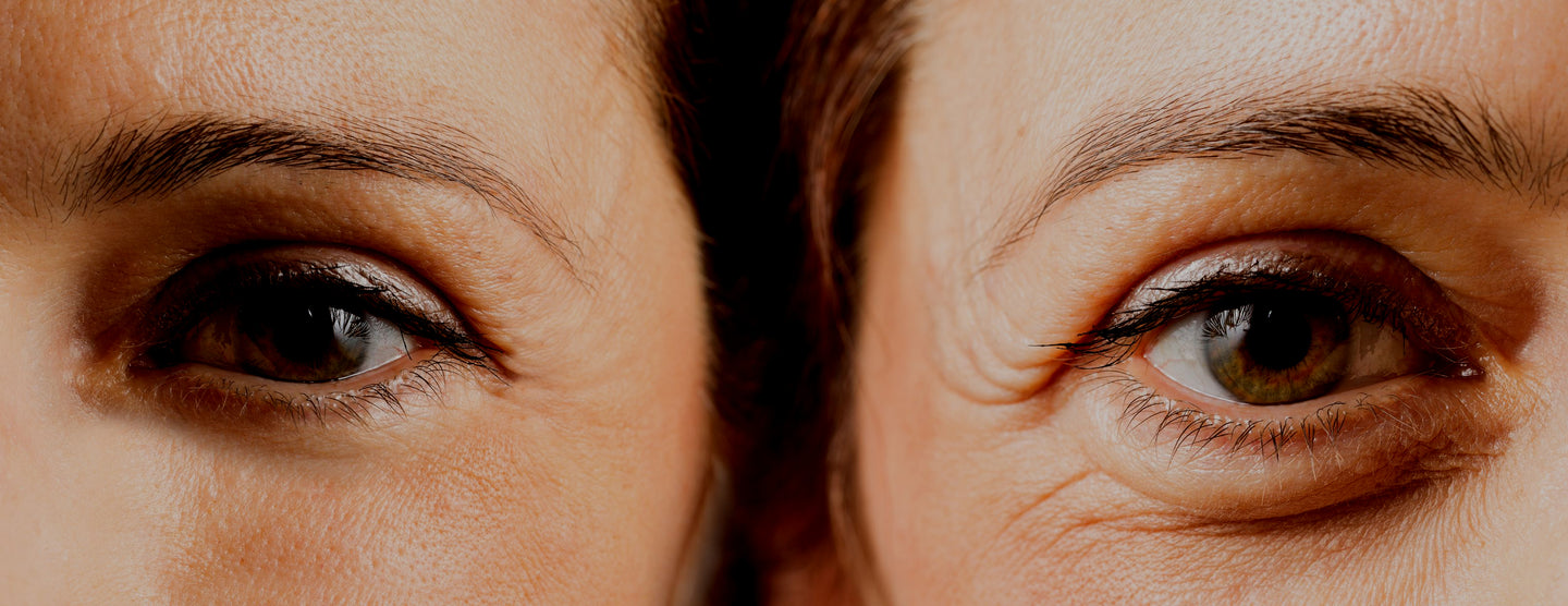 Eye Serums Proven to Reduce Crows Feet